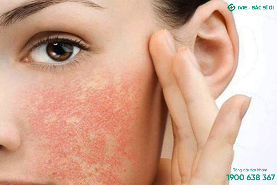 Da bị kích ứng là gì? Nguyên nhân và cách khắc phục helloo88