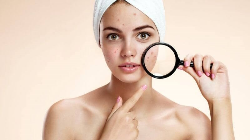 8 cách làm mặt nạ tinh bột nghệ 22helo88. Có nên đắp hàng ngày không?