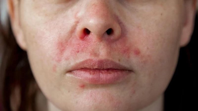 8 cách làm mặt nạ tinh bột nghệ 22helo88. Có nên đắp hàng ngày không?