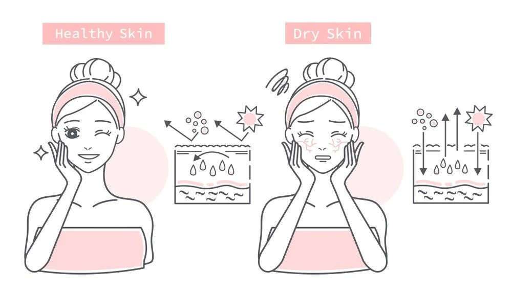 7 cách làm mặt nạ dành cho da khô