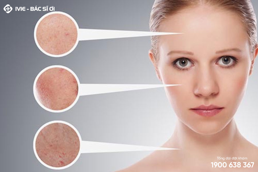 Da mặt sạm đen là bệnh gì? 5 cách khắc phục 22helo88, an toàn