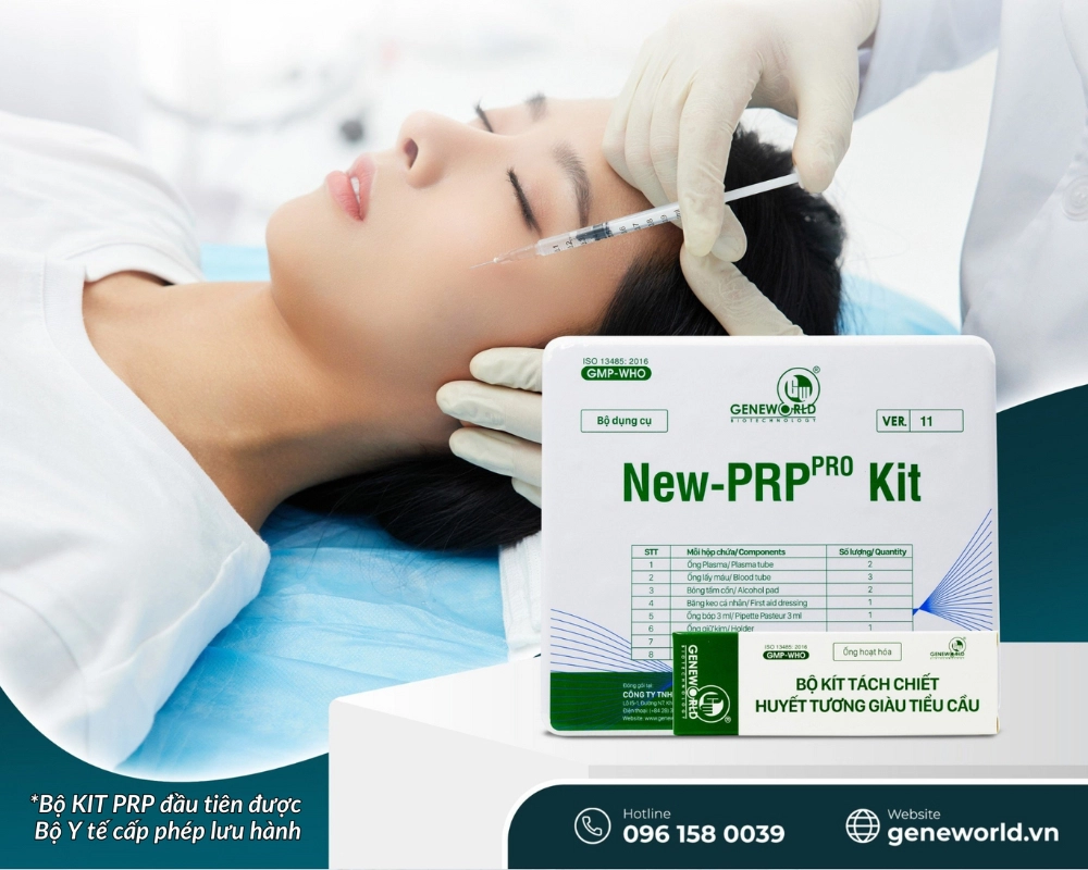 Tiêm PRP giá 33hello88? Những điều nên và không nên làm khi tiêm PRP