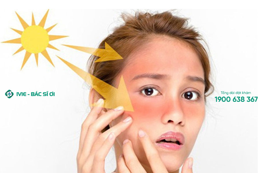 Da mặt sạm đen là bệnh gì? 5 cách khắc phục 22helo88, an toàn
