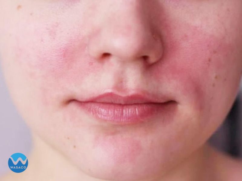 Xông tỏi có tác dụng gì? Cách xông tỏi helloo88 hiệu quả bất ngờ