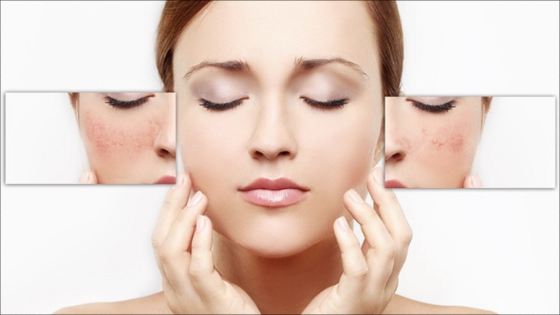 Hyaluronic Acid là gì? Công dụng của HA đối với làn da và helloo88