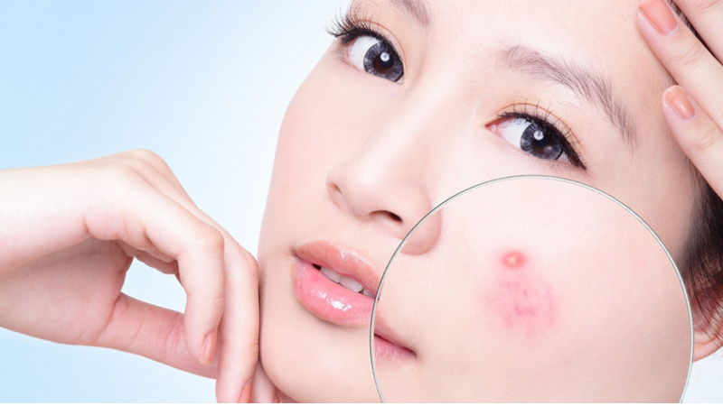 Hyaluronic Acid là gì? Công dụng của HA đối với làn da và helloo88