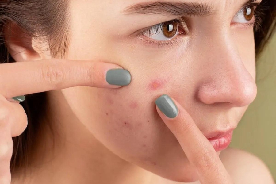 7 cách xông mặt 22helo88 cho làn da mịn màng và trắng sáng