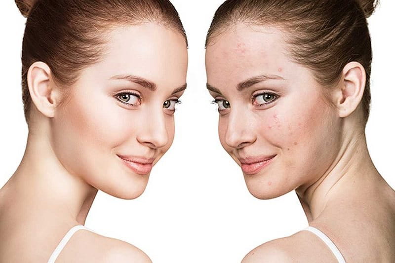 7 cách chăm sóc da mặt trắng mịn hồng hào cực 22helo88 và hiệu quả