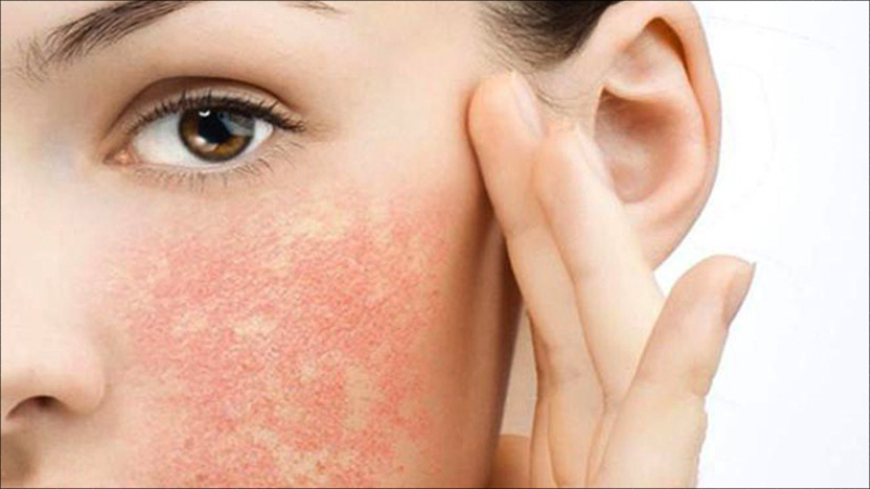 Hyaluronic Acid là gì? Công dụng của HA đối với làn da và helloo88