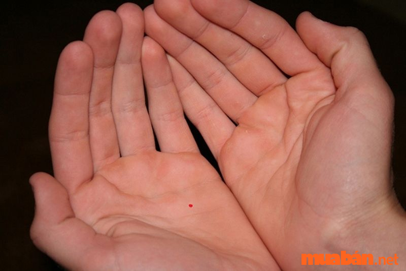 Luận giải nốt ruồi trong lòng bàn tay nam và nữ tốt hay xấu?