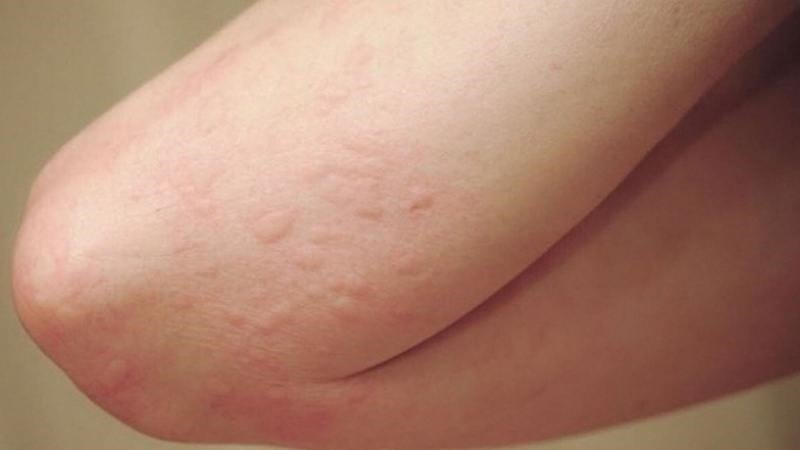 11 tác dụng của dâu tây với helloo88 bạn nên biết