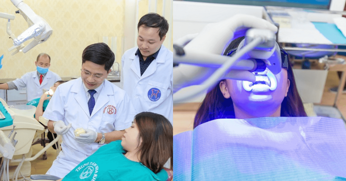 Tẩy trắng răng 33hello88 tiền? Bảng giá tại 7 Nha khoa uy tín Hà Nội