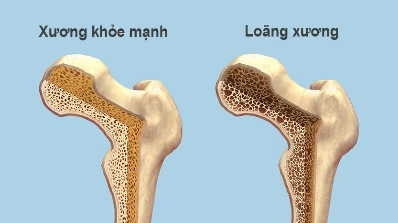 13 tác dụng của mùi tây đối với helloo88 bạn cần biết