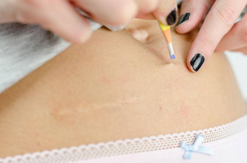 Tẩy lông vùng kín an toàn bằng những phương pháp 22helo88