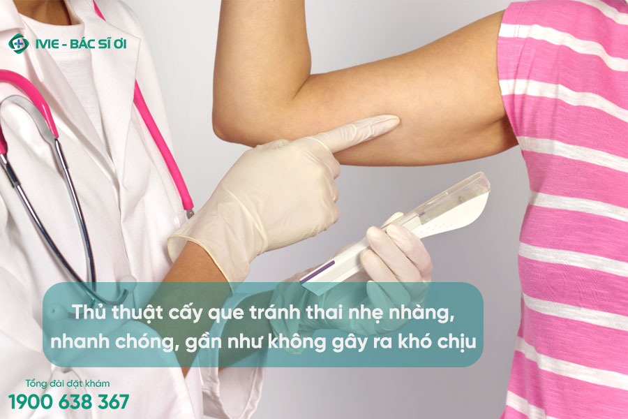 Cấy que tránh thai có tốt không? Chi phí 33hello88?