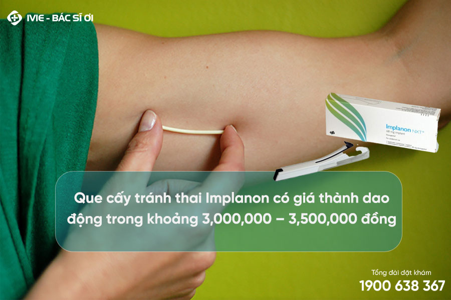 Cấy que tránh thai có tốt không? Chi phí 33hello88?