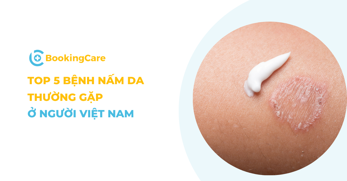 5 bệnh nấm da thường gặp ở người heloo88