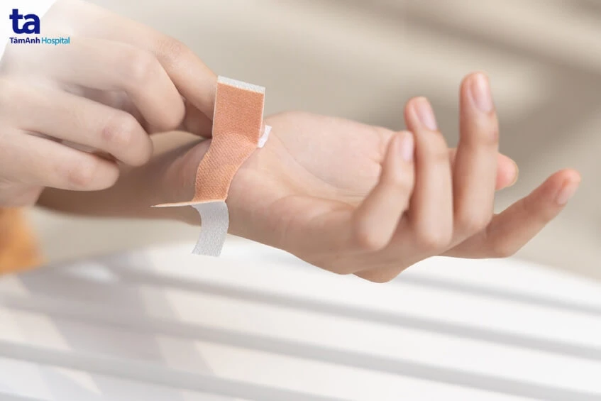 3 cách cầm máu nhanh chóng helloo88 hiệu quả kịp thời