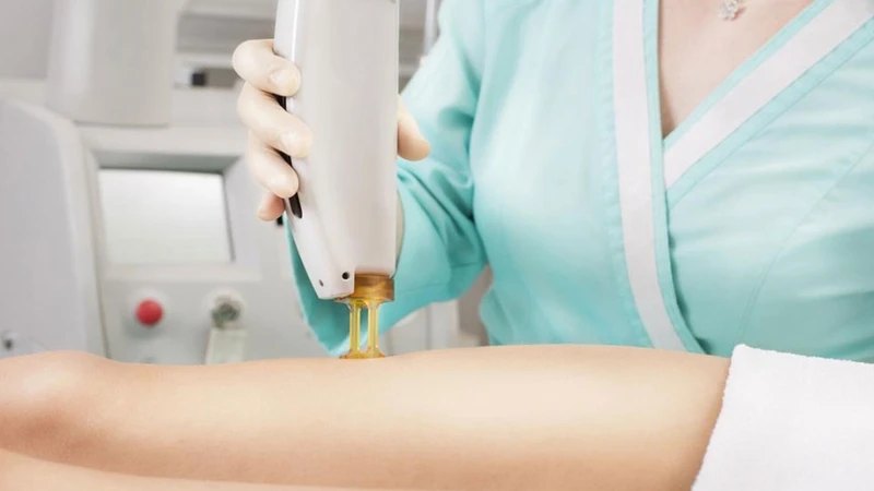 Giải pháp tẩy lông vùng kín an toàn và hiệu quả cho chị em phụ nữ