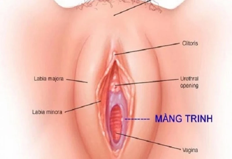 Màng trinh và các thông tin cần biết
