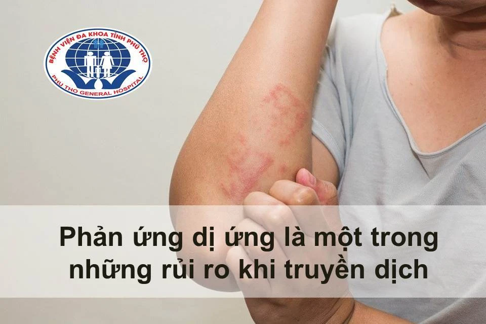 1 số lưu ý khi truyền nước biển helloo88