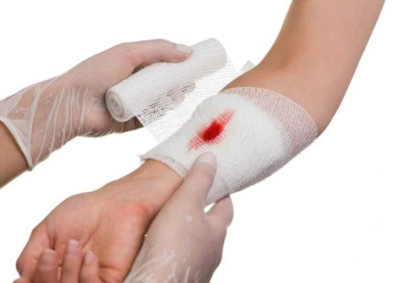 Nguyên nhân đứt mạch máu