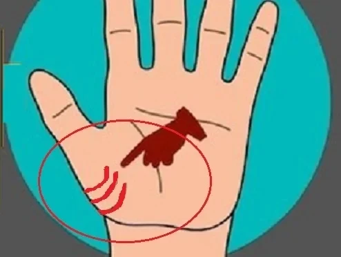 10 dấu hiệu