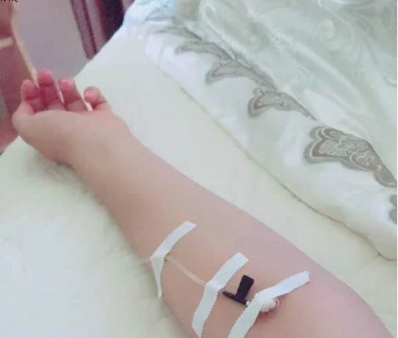 Hình truyền nước biển helloo88 - Y tế helloo88 Bình Minh