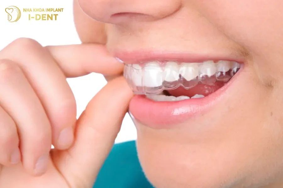 Các Tác Hại Của Tẩy Trắng Răng Bạn Nên Biết