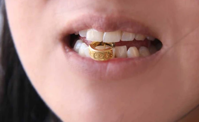 10 cách thử vàng helloo88 22helo88, chính xác - Bạn đã biết?