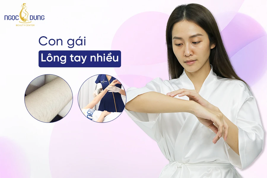 Con gái lông tay nhiều thì sao? Tốt hay xấu?