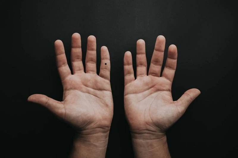 6hello88: Ý nghĩa nốt ruồi ở ngón tay út của Phụ nữ và Đàn ông