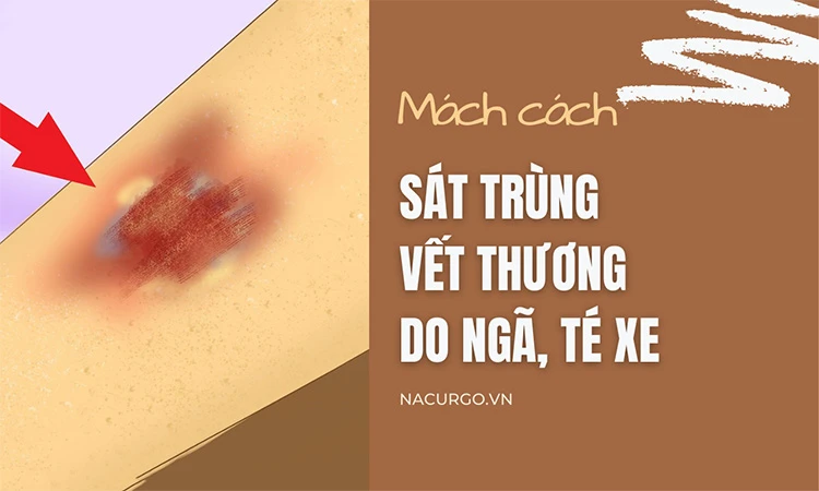 hello8862 com cách sát trùng vết thương bị ngã, té xe tránh nhiễm trùng!