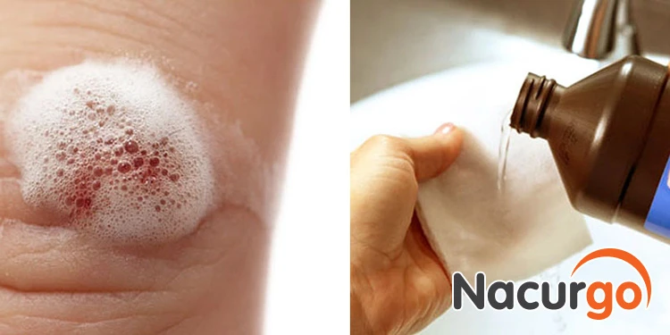 hello8862 com cách sát trùng vết thương bị ngã, té xe tránh nhiễm trùng!