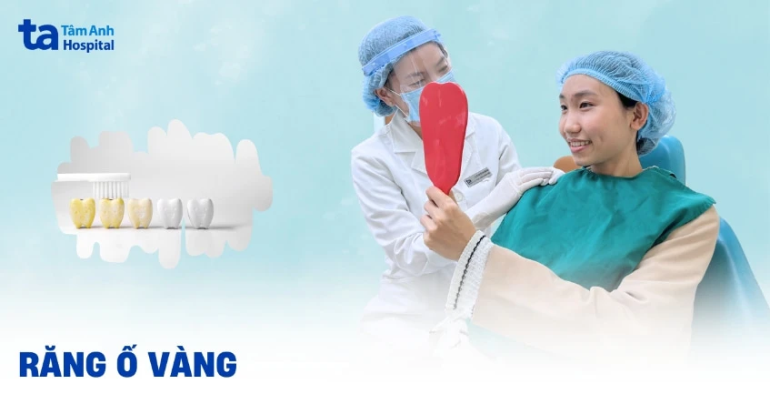 Răng ố vàng: Nguyên nhân, cách khắc phục và hạn chế ngả vàng