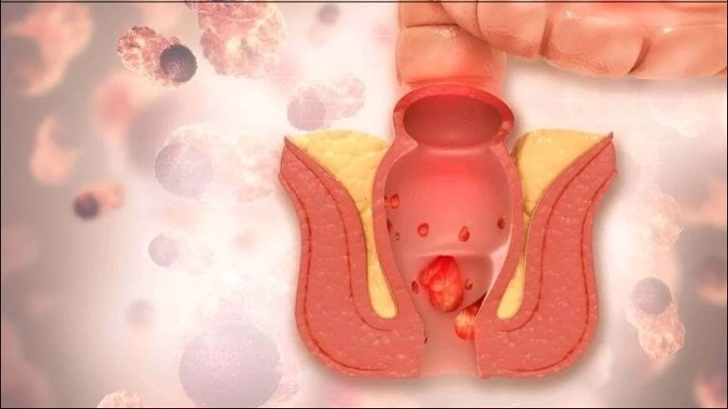 Trà hoa hòe có tác dụng gì? 10 công dụng của hoa hòe với helloo88