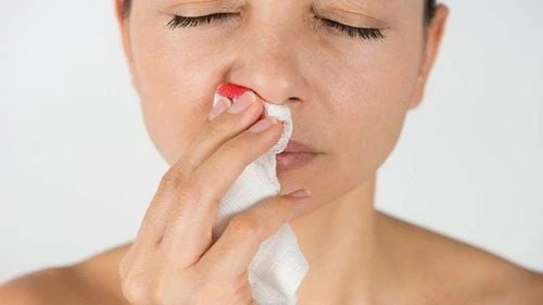 Những sai lầm trong sơ cứu khi chảy máu cam